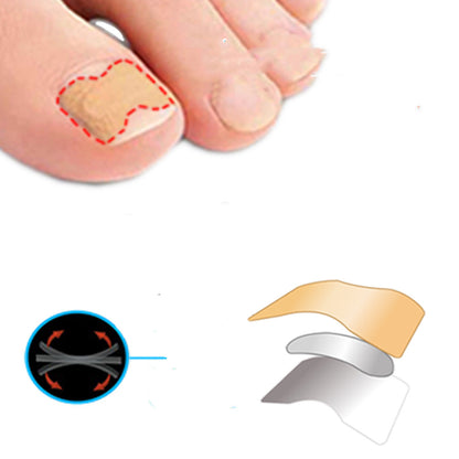 Nail Treatment Strip™