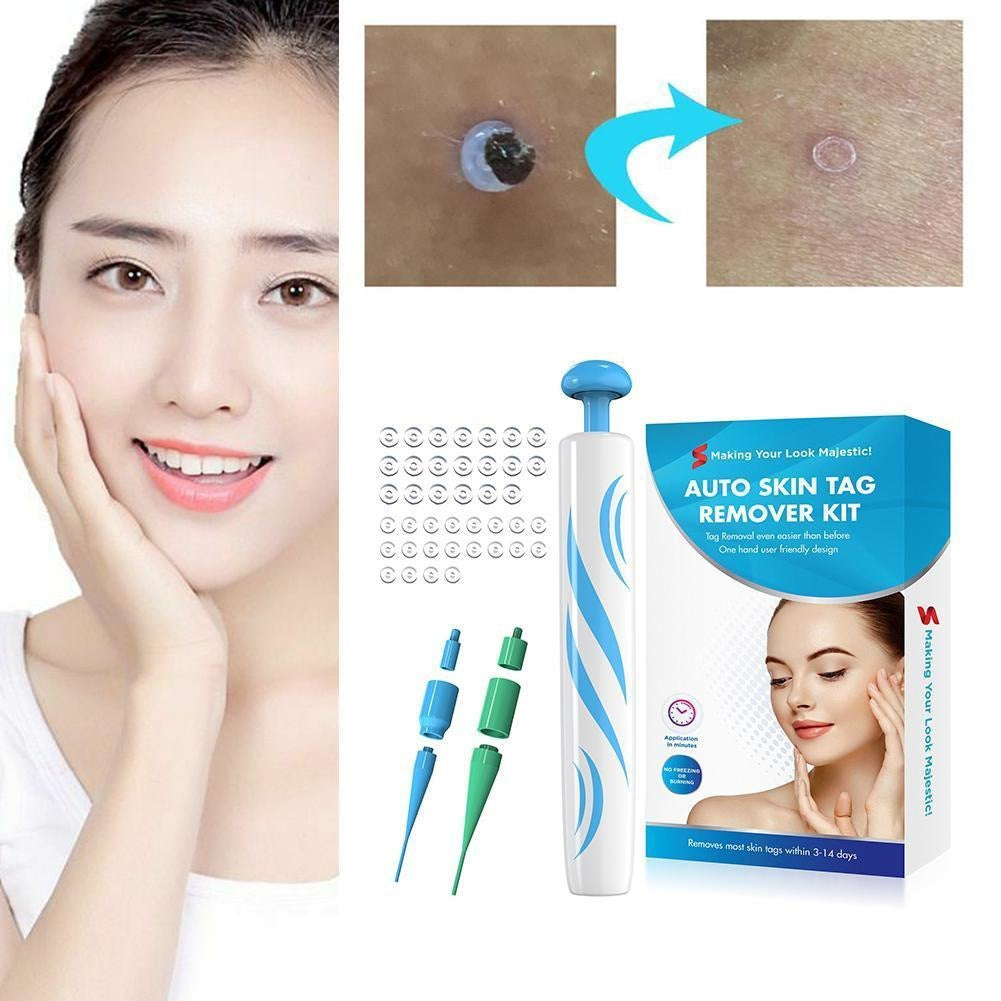 Skin Tag Remover